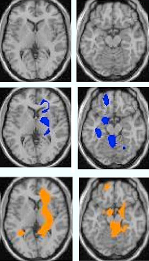 Brain Scans